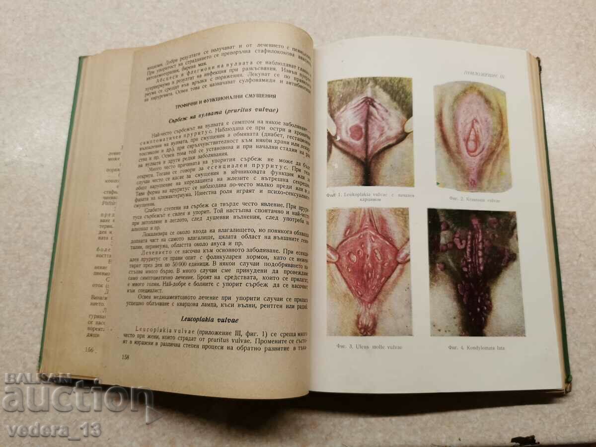 Delivery of 1958 TEXTBOOK OF GYNECOLOGY. Delivery of 1958 TEXTBOOK OF GYNECOLOGY.