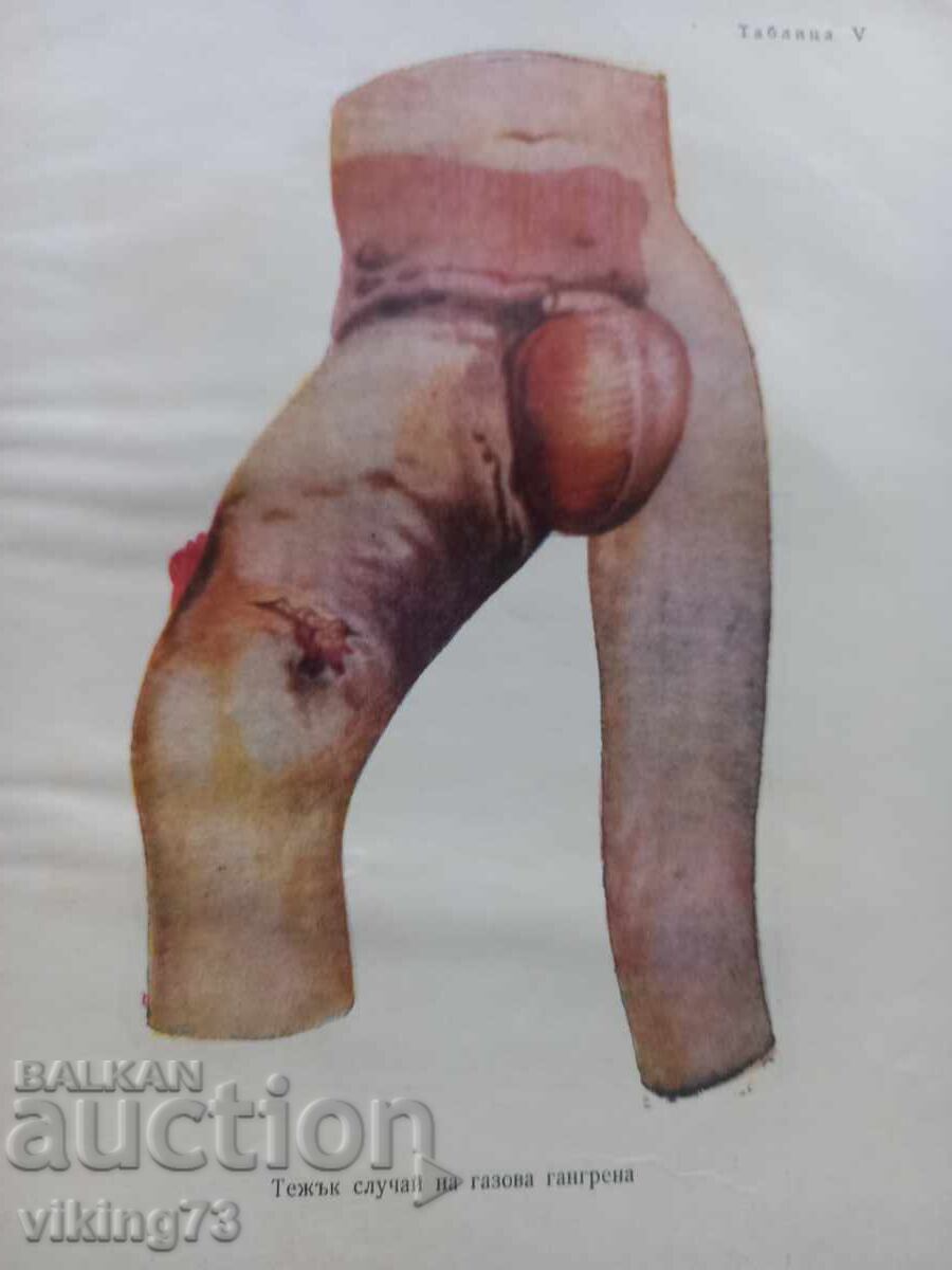 Textbook of surgery, BG, 1957. with price 15.00 BGN | € 7.67 Textbook of surgery, BG, 1957. with price 15.00 BGN | € 7.67