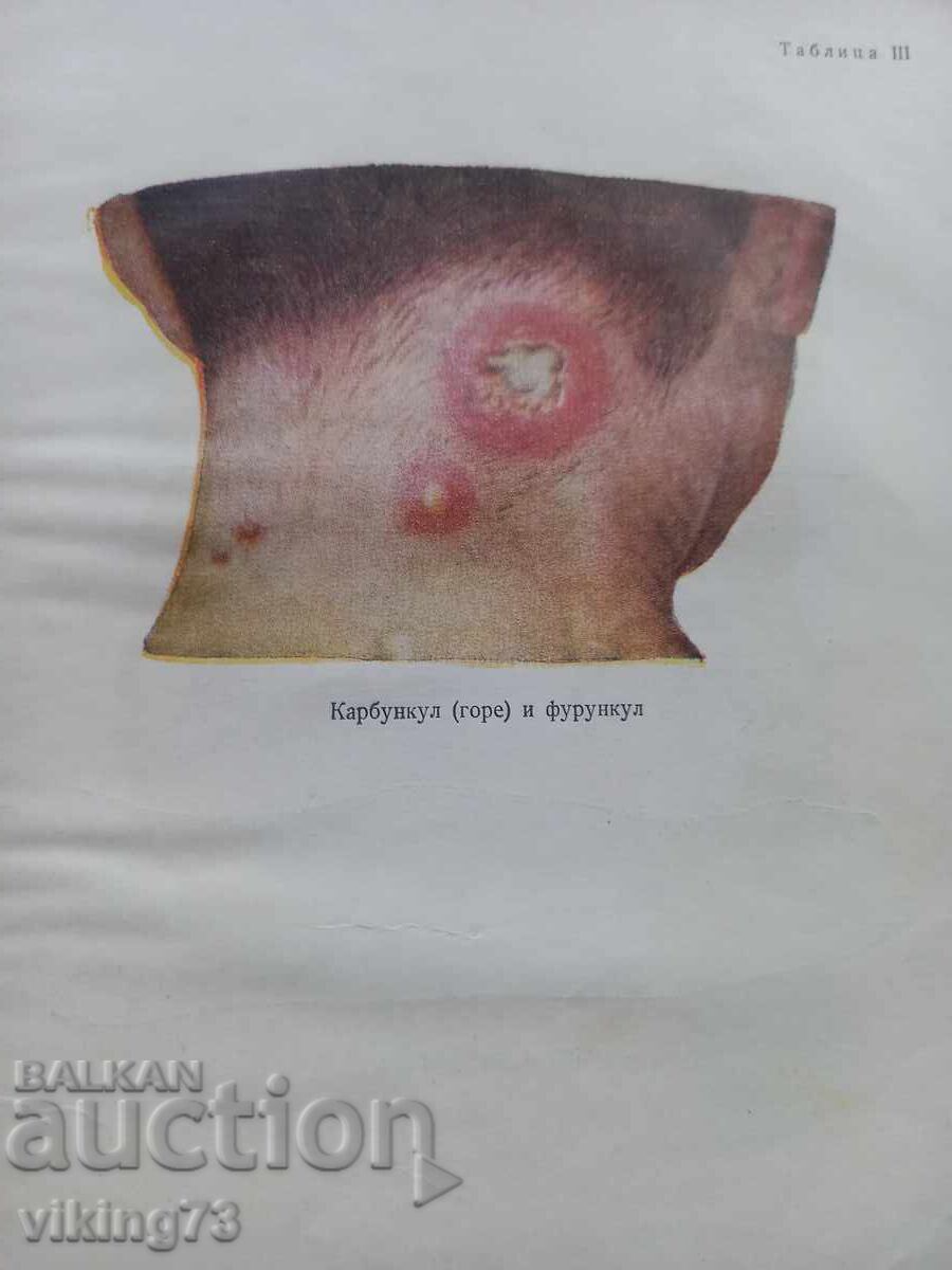 Auction Textbook of surgery, BG, 1957. Auction Textbook of surgery, BG, 1957.