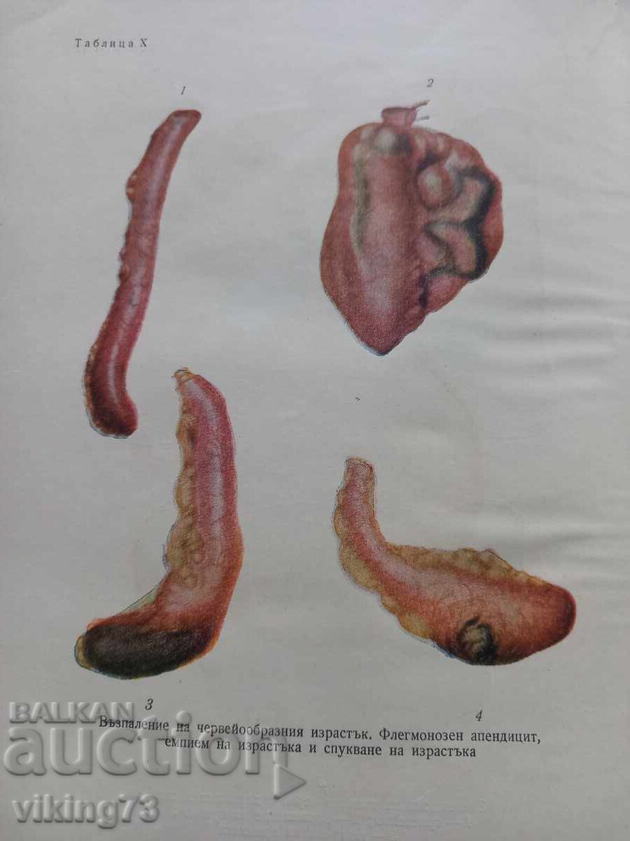 Textbook of surgery, BG, 1957. - 5 Textbook of surgery, BG, 1957. - 5
