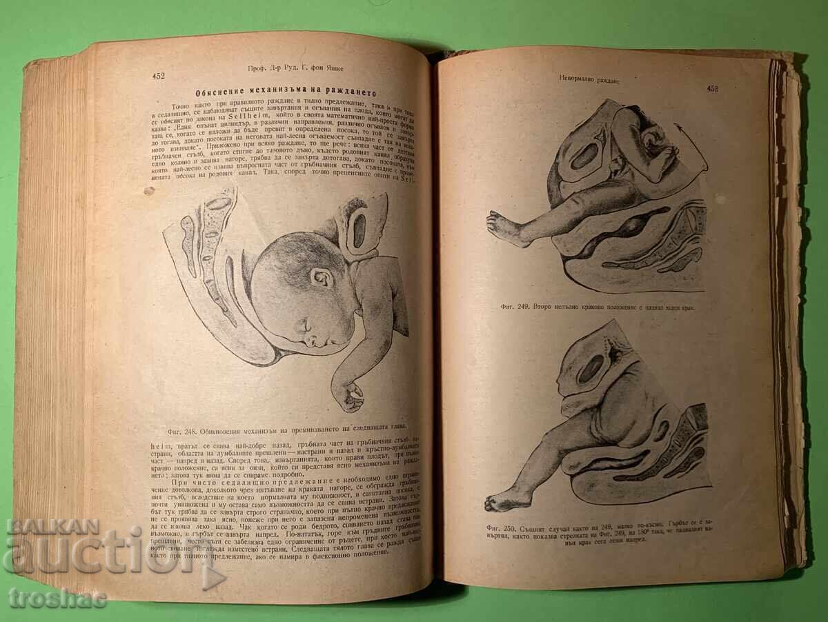 Стара Книга Акушерство /Д-р Д.Колин 1948г. - 7
