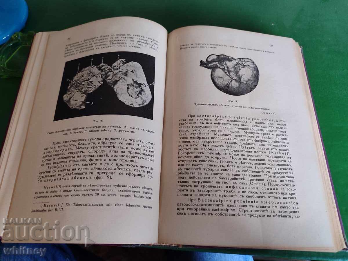 Delivery of Fundamentals of Gynecology 1939-1942 Delivery of Fundamentals of Gynecology 1939-1942