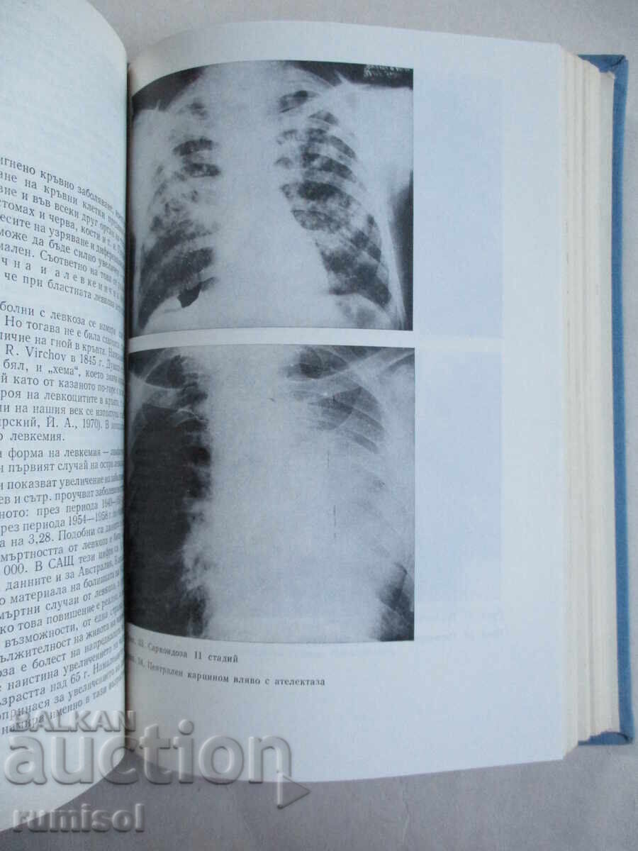 Manual of Internal Medicine - 2 - Atanas Maleev - 5 Manual of Internal Medicine - 2 - Atanas Maleev - 5