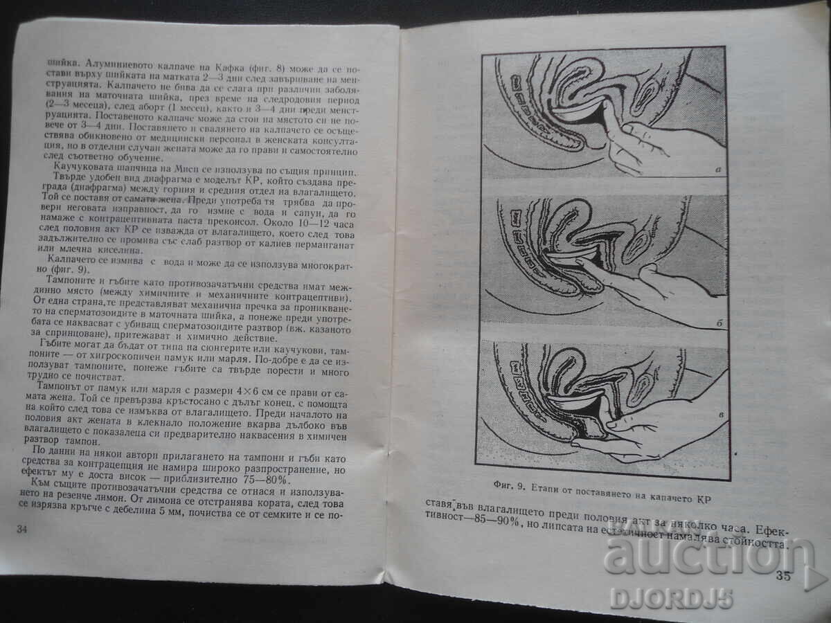 Medicamente contraceptive, S. Davidov - 5 Medicamente contraceptive, S. Davidov - 5