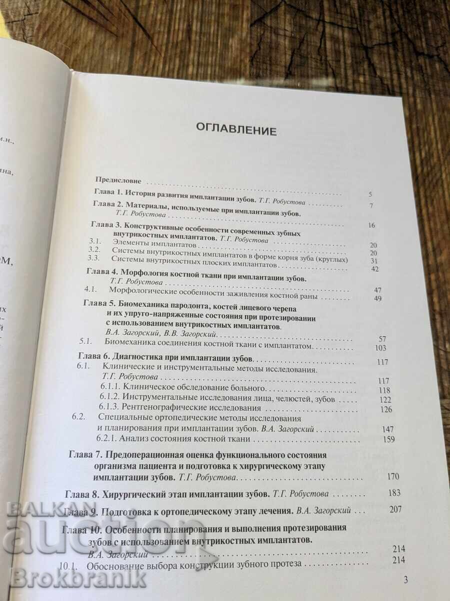 Licitație Protezare dentară pe implanturi