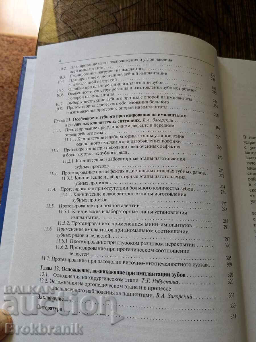 Παράδοση Εμφυτεύματα δοντιών (Προσθετική) Παράδοση Εμφυτεύματα δοντιών (Προσθετική)