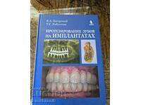 Εμφυτεύματα δοντιών (Προσθετική)