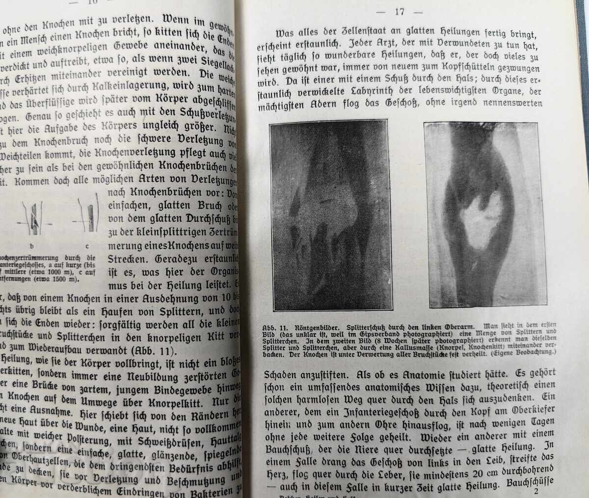 Θεράπευε και βοήθει, γερμανικά, 1916. Α' ΠΠ - 5