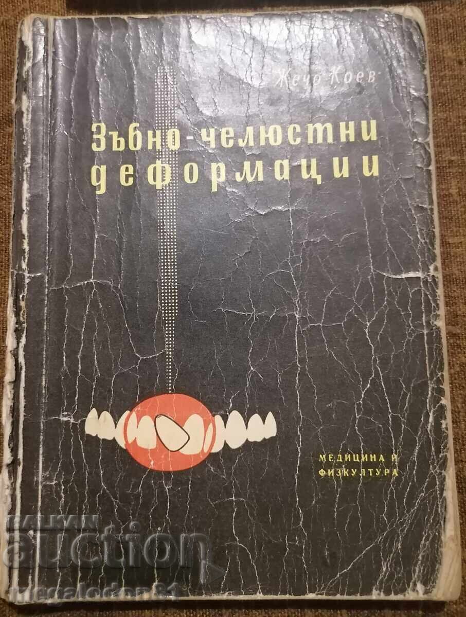 Ορθοδοντικές δυσμορφίες, Ζέτσο Κοεφ