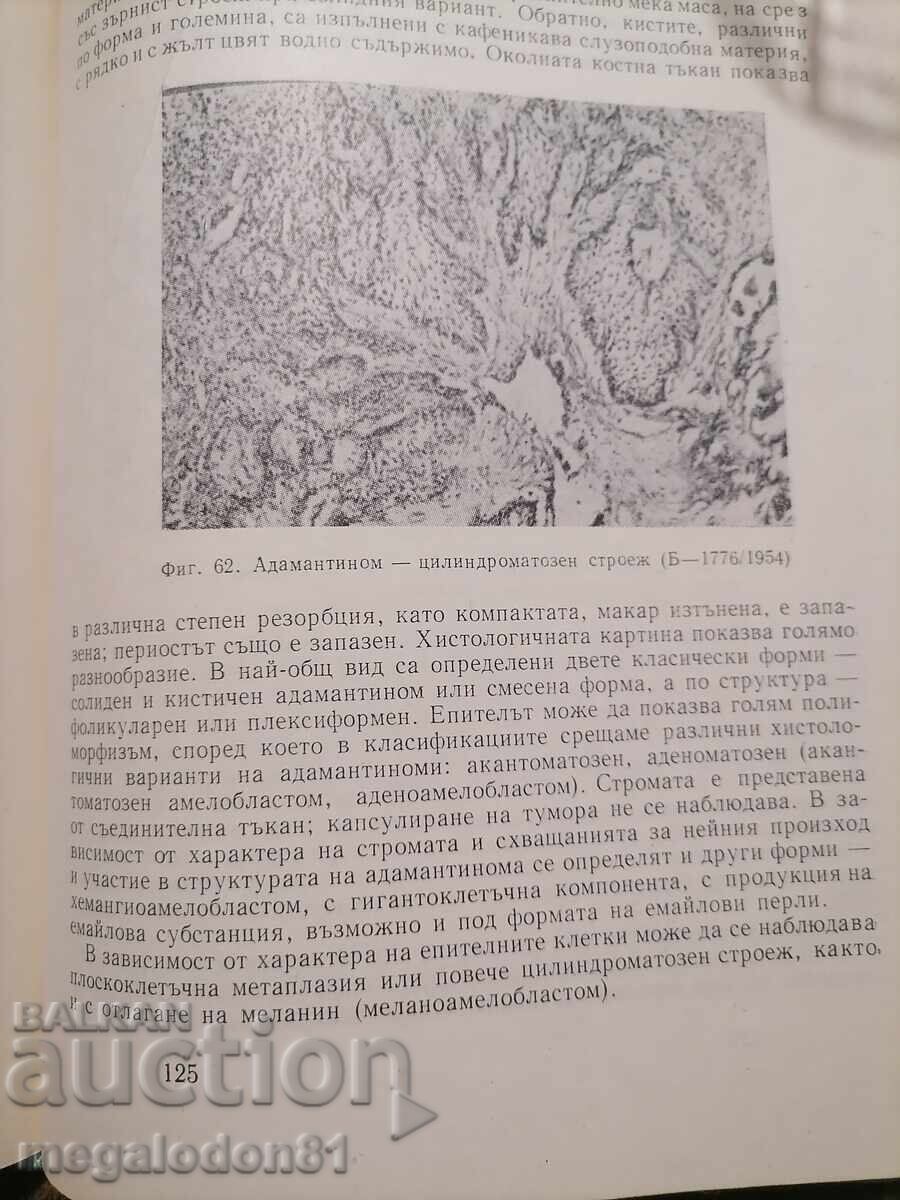 Morphological diagnosis of stomatological discolorations with price 8.00 BGN | € 4.09