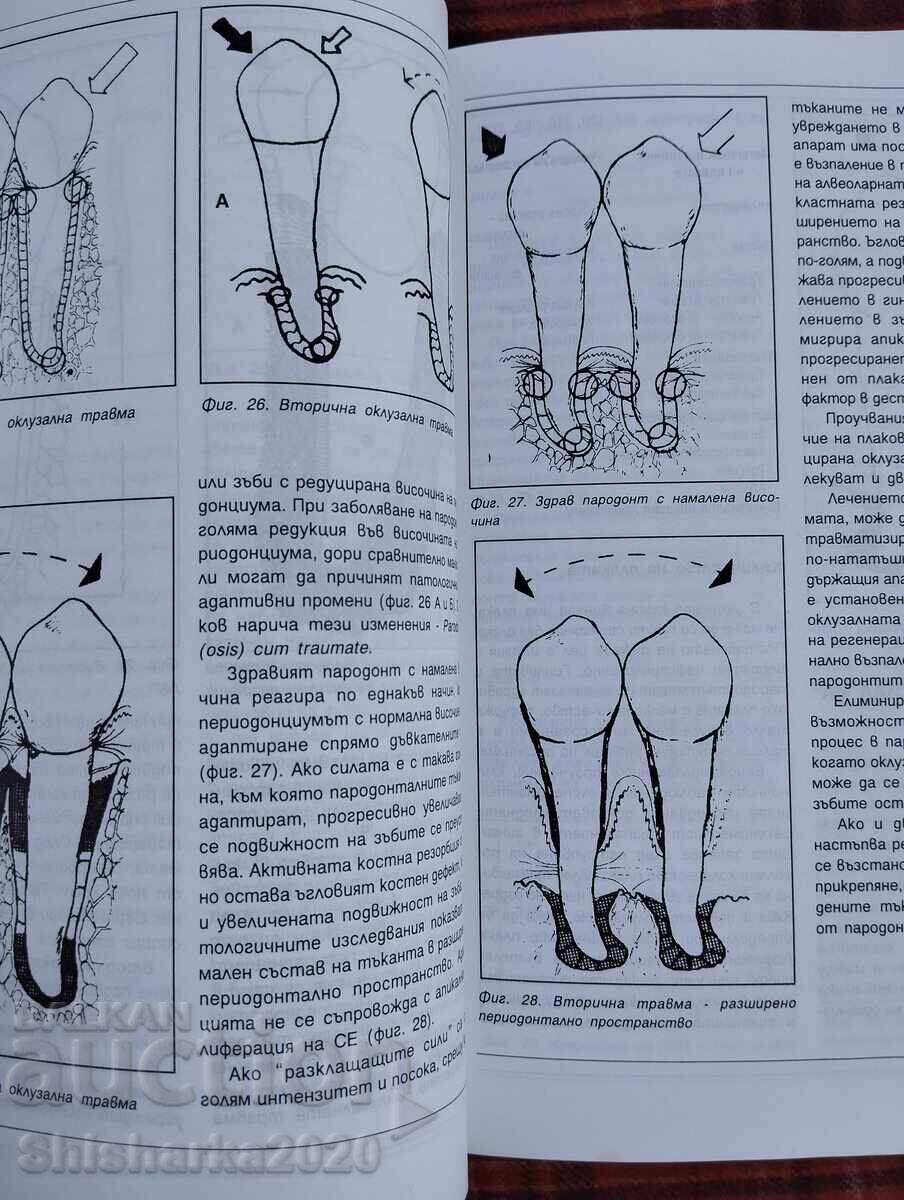 Δημοπρασία Διάγνωση και θεραπεία φλεγμονωδών νόσων του περιοδοντίου