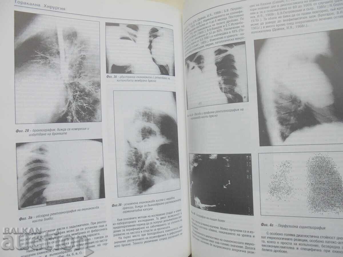 Thoracic Surgery - Petar Chervenyakov et al. 1997 - 6 Thoracic Surgery - Petar Chervenyakov et al. 1997 - 6