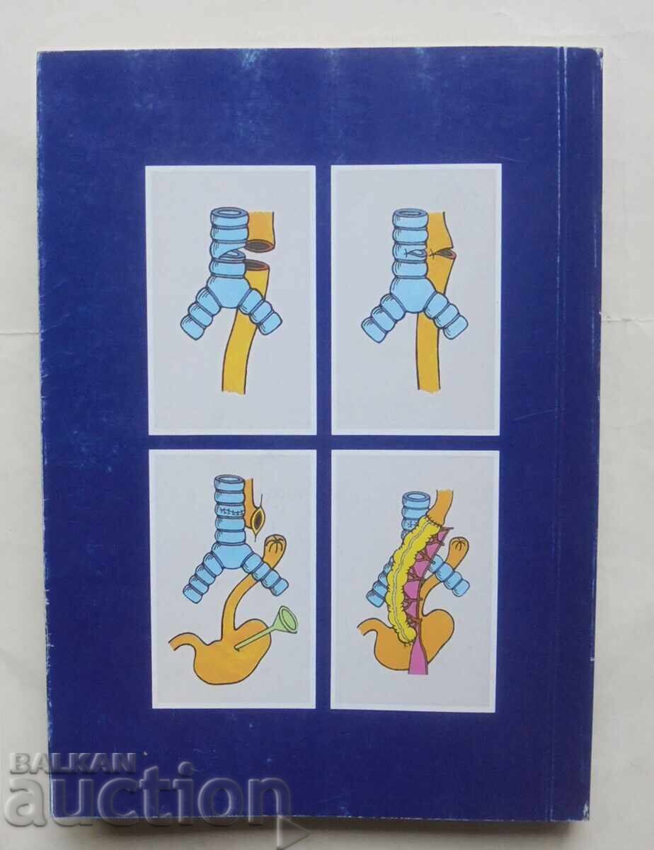Thoracic Surgery - Petar Chervenyakov et al. 1997 - 7 Thoracic Surgery - Petar Chervenyakov et al. 1997 - 7