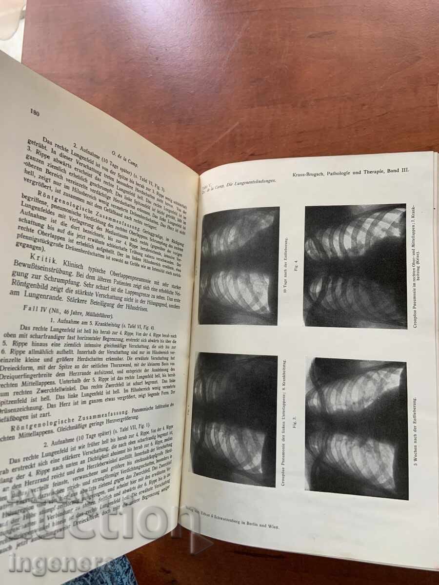 PATHOLOGY AND THERAPY OF INTERNAL DISEASES / LUNGS, NOSE, ETC with price 19.00 BGN | € 9.71