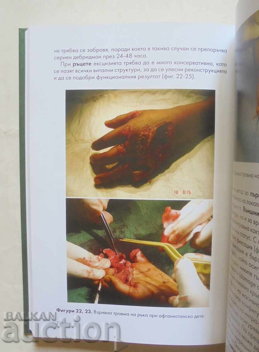 Τραύμα από έκρηξη - Βεντζισλάβ Μουταφτσίισκι και άλλοι. 2022 - 7 Τραύμα από έκρηξη - Βεντζισλάβ Μουταφτσίισκι και άλλοι. 2022 - 7