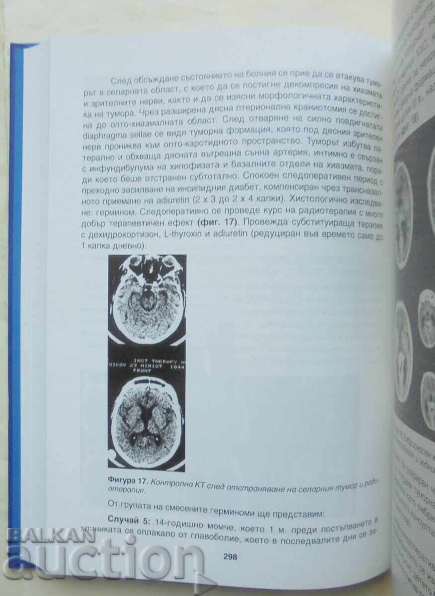 Νευροχειρουργική παθολογία του τρίτου κοιλιακού 2020 με τιμή 80.00 BGN | € 40.90 Νευροχειρουργική παθολογία του τρίτου κοιλιακού 2020 με τιμή 80.00 BGN | € 40.90