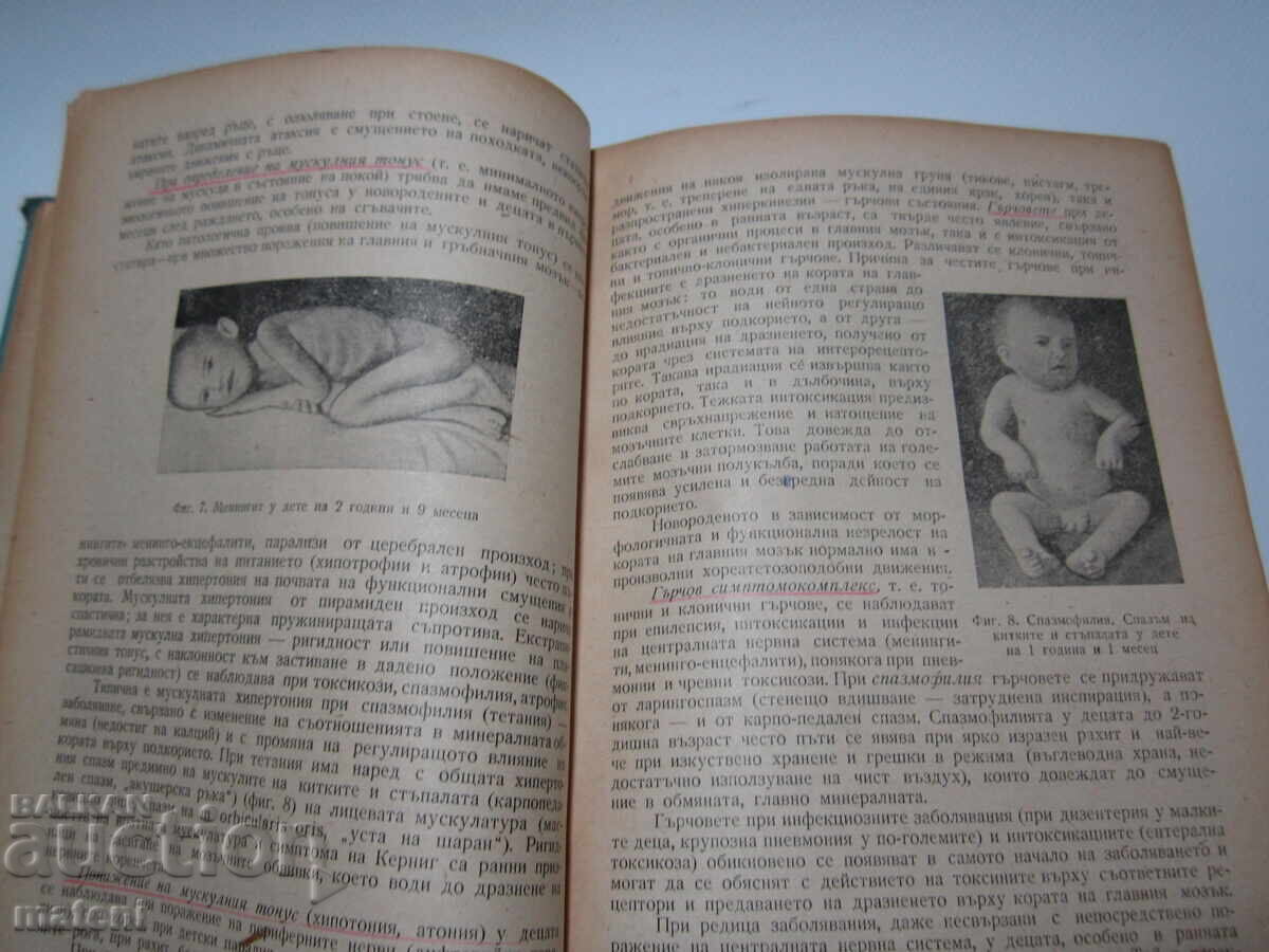 ΠΑΛΑΙΟ ΙΑΤΡΙΚΟ ΒΙΒΛΙΟ ΠΡΟΠΑΙΔΕΥΤΙΚΗ ΤΩΝ ΠΑΙΔΙΚΩΝ ΑΣΘΕΝΕΙΩΝ - 5