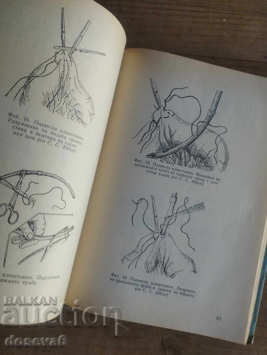 Доставка на Чревна непроходимост (илеус)