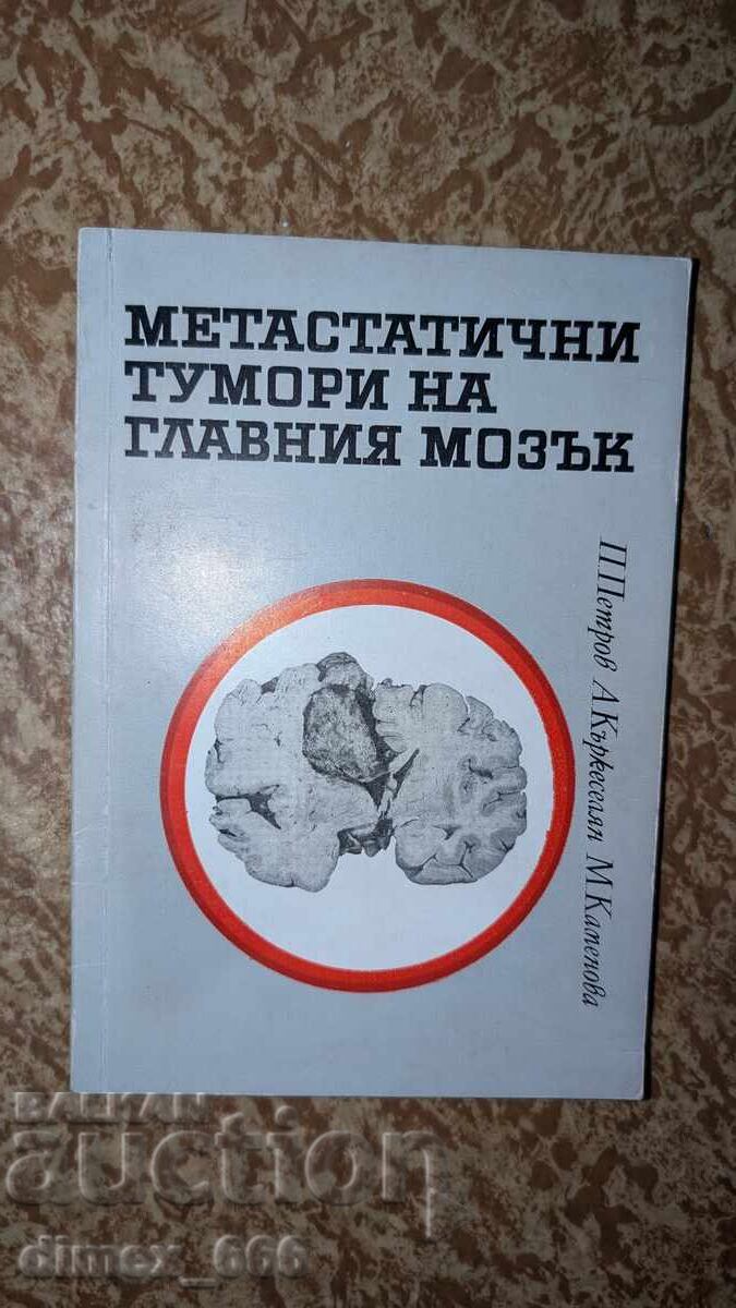 Metastatichni tumori na glavnia mozyk P. Petrov, A. Kyrkeselya Metastatichni tumori na glavnia mozyk P. Petrov, A. Kyrkeselya