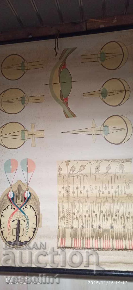 Παλιό εκπαιδευτικό ταμπλό από το Deutsches Hygiene-Museum, εστίαση