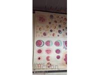 Vechi panou educațional de la Deutsches Hygiene-Museum celule sanguine