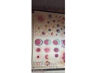 Старо учебно табло от Deutsches higiene-museum кръвни клетки