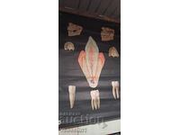 Tablă didactică veche de la Deutsches Hygiene-Museum dinții sănătoși