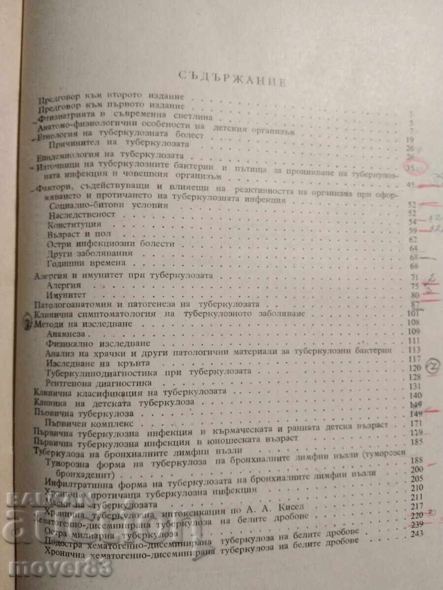 Παράδοση Τη φυματίωση στα παιδιά. Ράνταν Ραντάνοφ Παράδοση Τη φυματίωση στα παιδιά. Ράνταν Ραντάνοφ