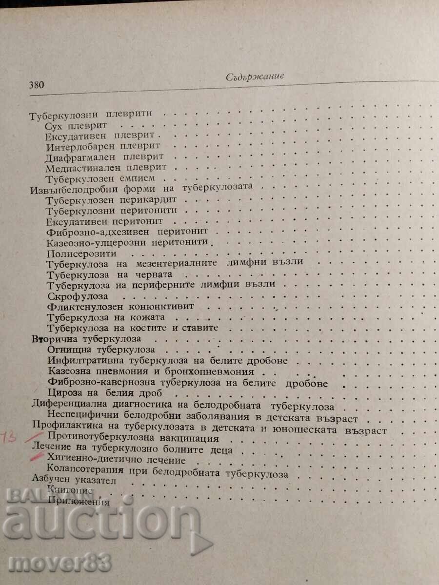 Τη φυματίωση στα παιδιά. Ράνταν Ραντάνοφ - 5 Τη φυματίωση στα παιδιά. Ράνταν Ραντάνοφ - 5