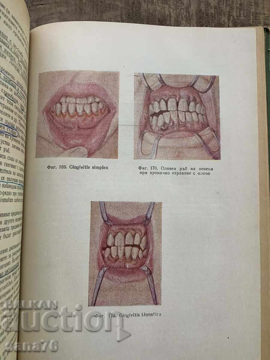Θεραπευτική Οδοντιατρική - Δημήτρης Σβράκοφ - 6