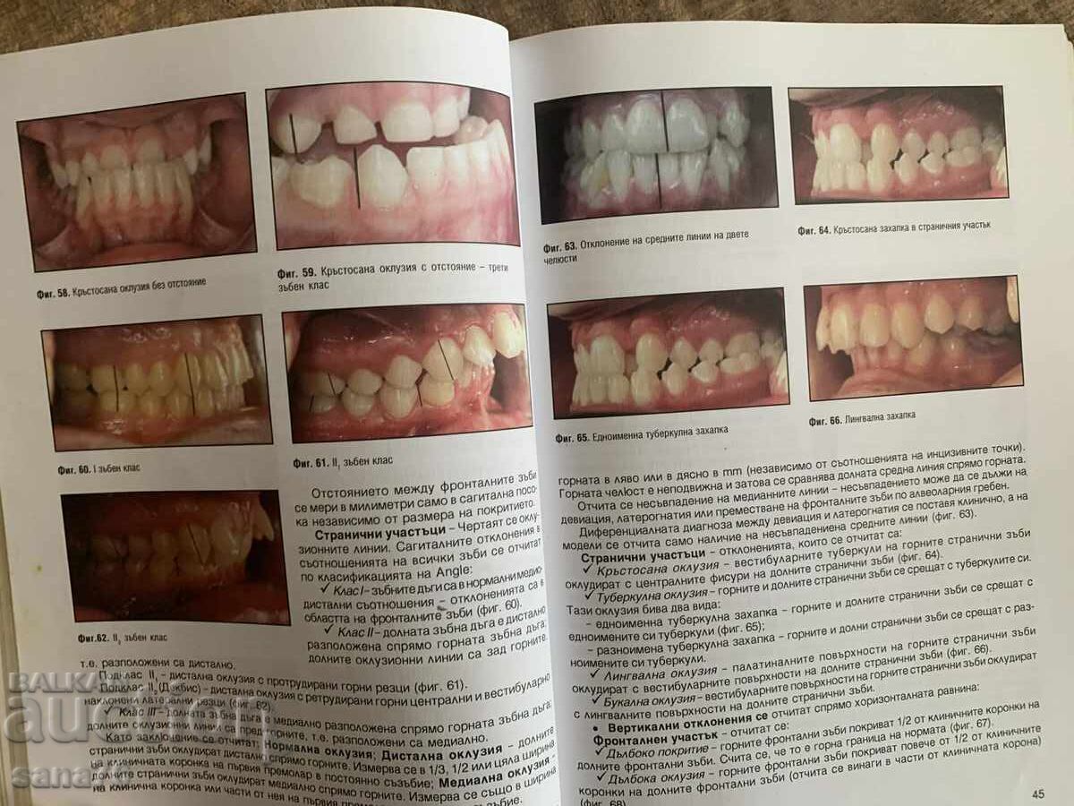 Ghid de ortodonție pentru studenți - prof. Vera Krumova - 6 Ghid de ortodonție pentru studenți - prof. Vera Krumova - 6