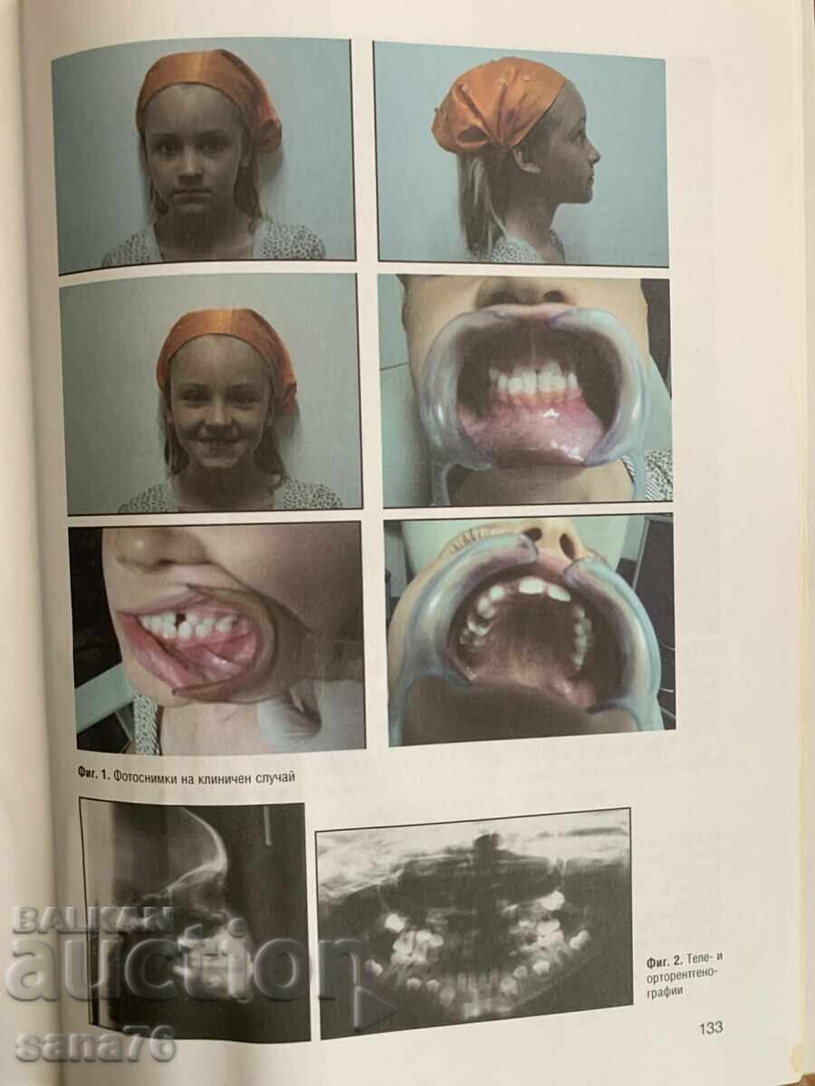 Ghid de ortodonție pentru studenți - prof. Vera Krumova - 7 Ghid de ortodonție pentru studenți - prof. Vera Krumova - 7