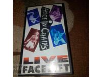 LIFTING FACIAL ÎN DIRECT - Caseta video - ROCK