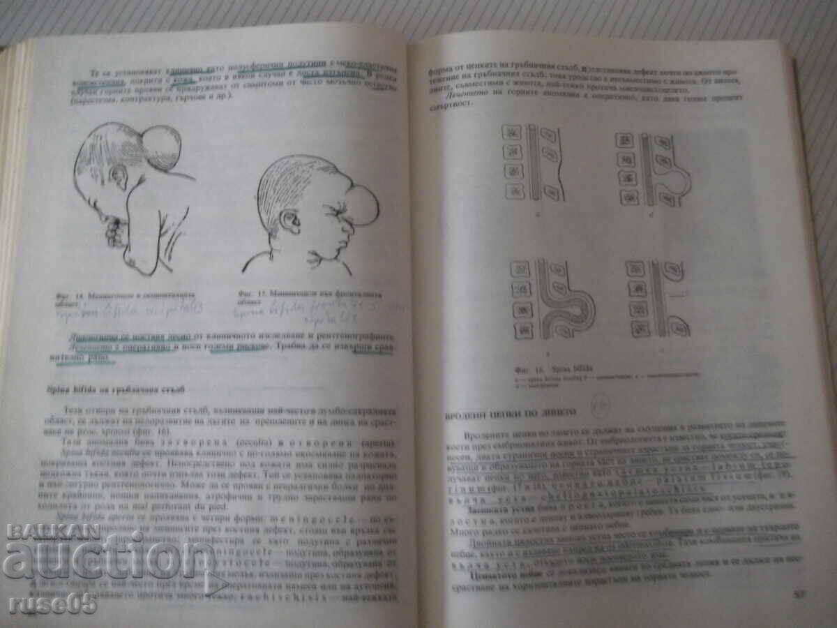 Книга "Пропедевтика на хирургичните болести-Г.Ганчев"-392стр с цена € 2.56 | 5.01 лв.