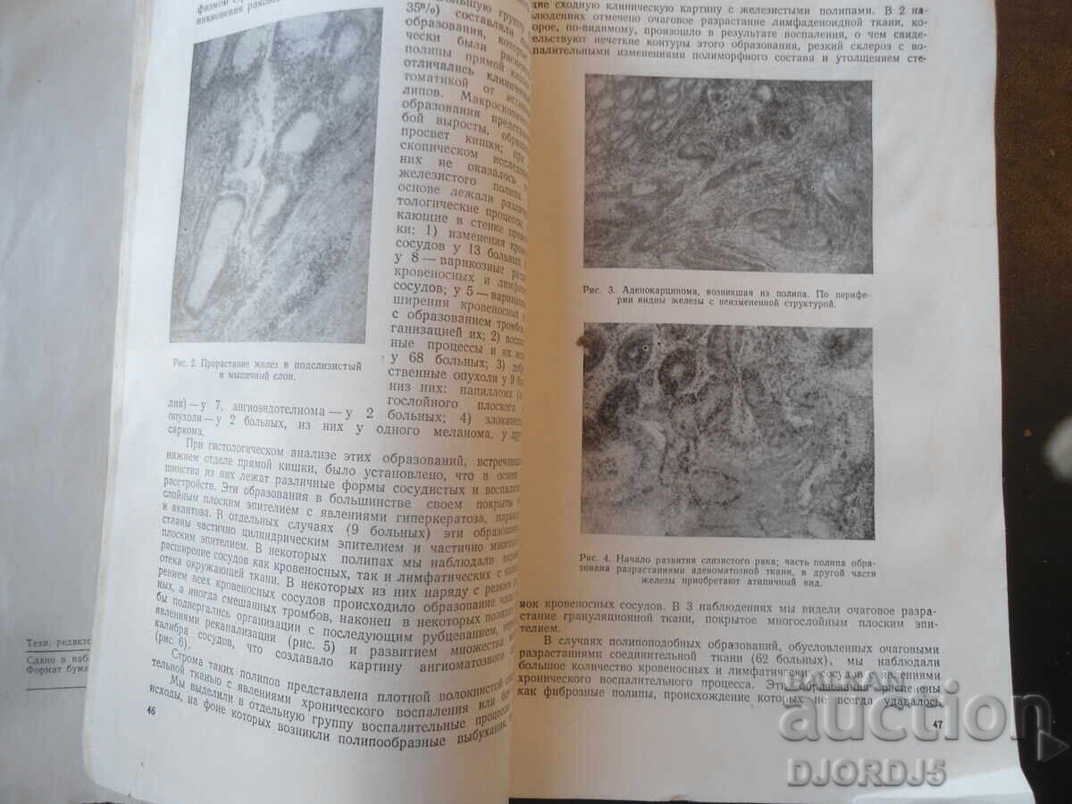 Licitație CHIRURGIA, Numărul 9, Septembrie, Moscova 1958 g