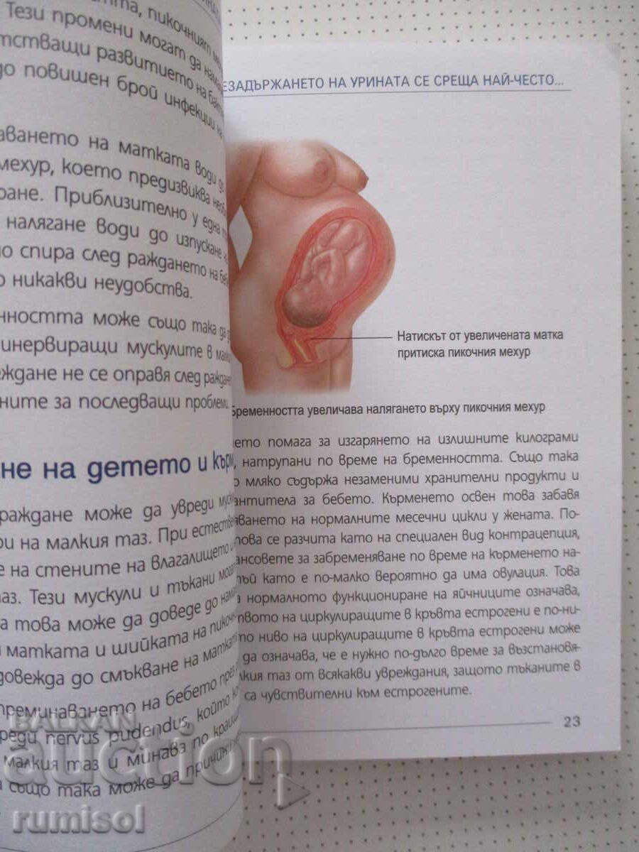Доставка на Незадържане на урината у жените-Л. Д. Кардосо, Ф. Тудж-Хобсъ