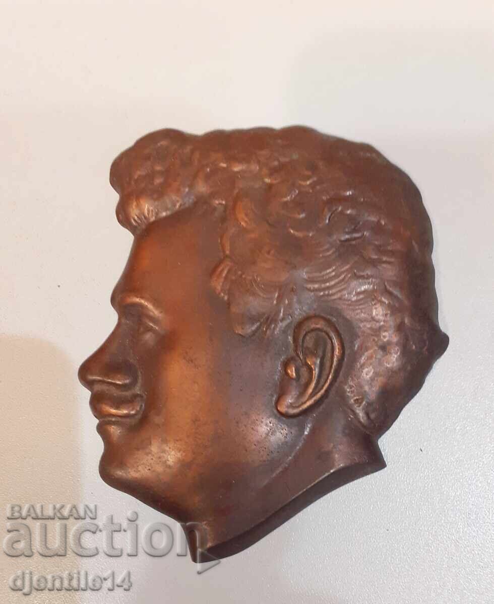 Πλαστική χειρουργική Αλεξάνταρ Stamboliĭski - 7