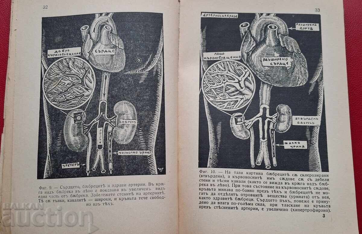 Αντίκα βιβλίο - Αθηροσκλήρωση - 5