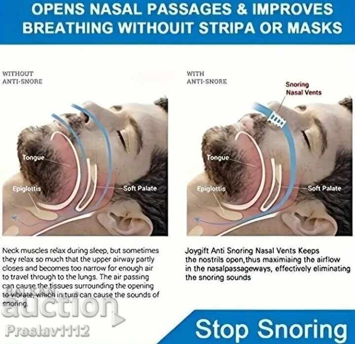 Delivery of Anti-snoring device