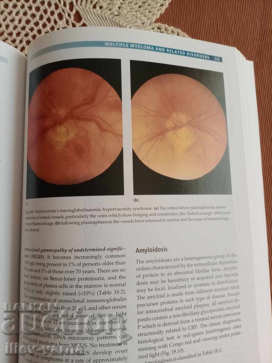 Licitație Hematologie