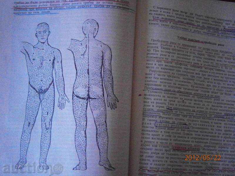 Prof.G. Kapitanov - General Surgery 1965 - 5 Prof.G. Kapitanov - General Surgery 1965 - 5