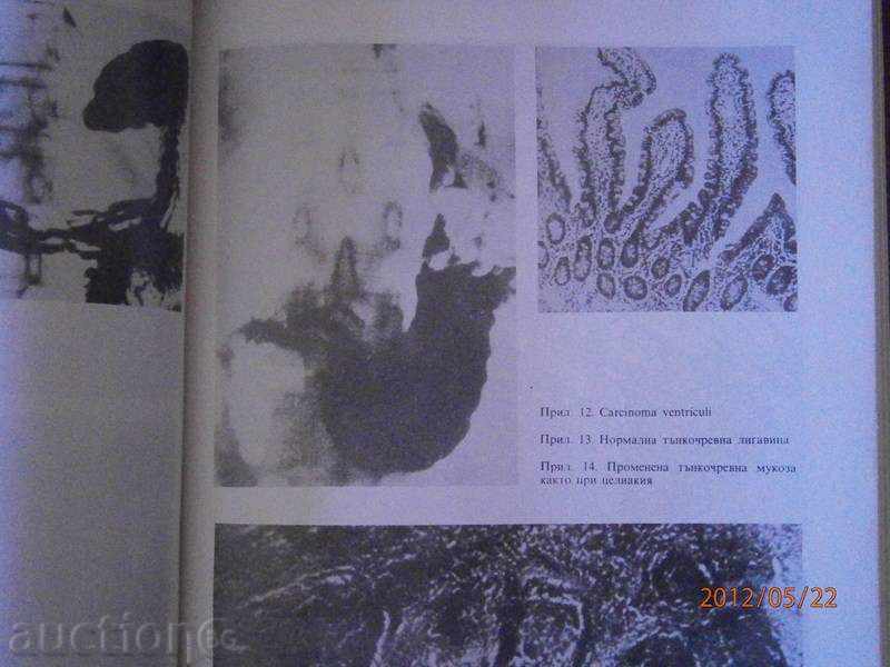 Παράδοση Οδηγός για τις εσωτερικές ασθένειες. Τόμος 4 του 1987 Παράδοση Οδηγός για τις εσωτερικές ασθένειες. Τόμος 4 του 1987