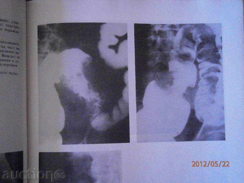 Οδηγός για τις εσωτερικές ασθένειες. Τόμος 4 του 1987 - 5 Οδηγός για τις εσωτερικές ασθένειες. Τόμος 4 του 1987 - 5