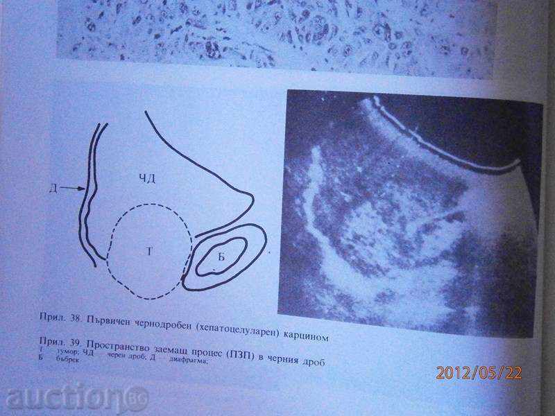 Οδηγός για τις εσωτερικές ασθένειες. Τόμος 4 του 1987 - 6 Οδηγός για τις εσωτερικές ασθένειες. Τόμος 4 του 1987 - 6