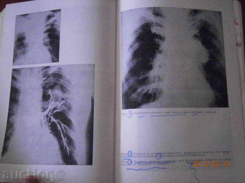 AUTHOR COLLEGE - Internal Diseases - Volume 2 - 1984 - 5 AUTHOR COLLEGE - Internal Diseases - Volume 2 - 1984 - 5