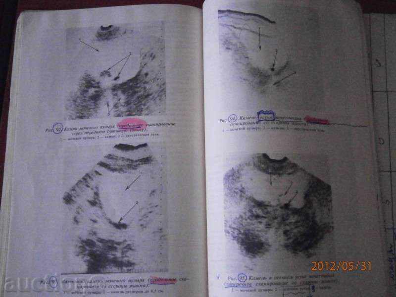 Ультразвуковая диагностика в уронефрологии - 1989 - Moscow with price 4.80 BGN | € 2.45