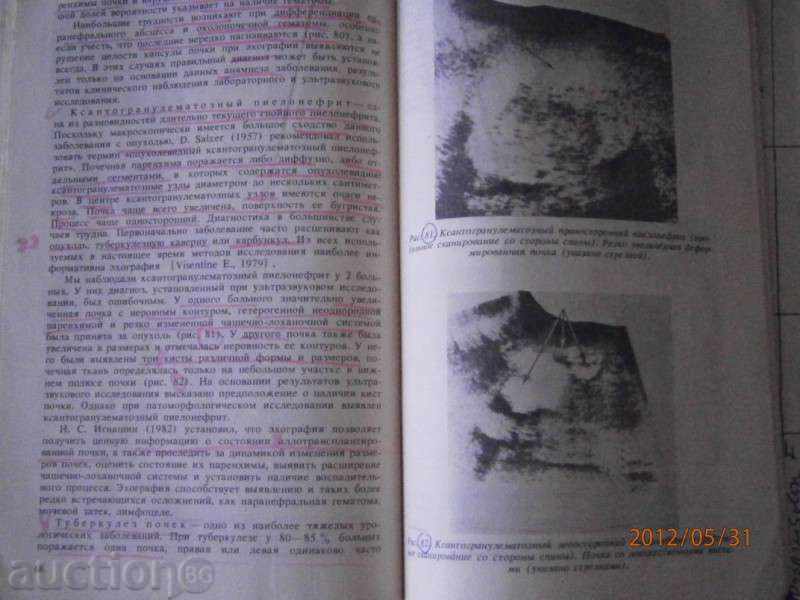 Delivery of Ультразвуковая диагностика в уронефрологии - 1989 - Moscow