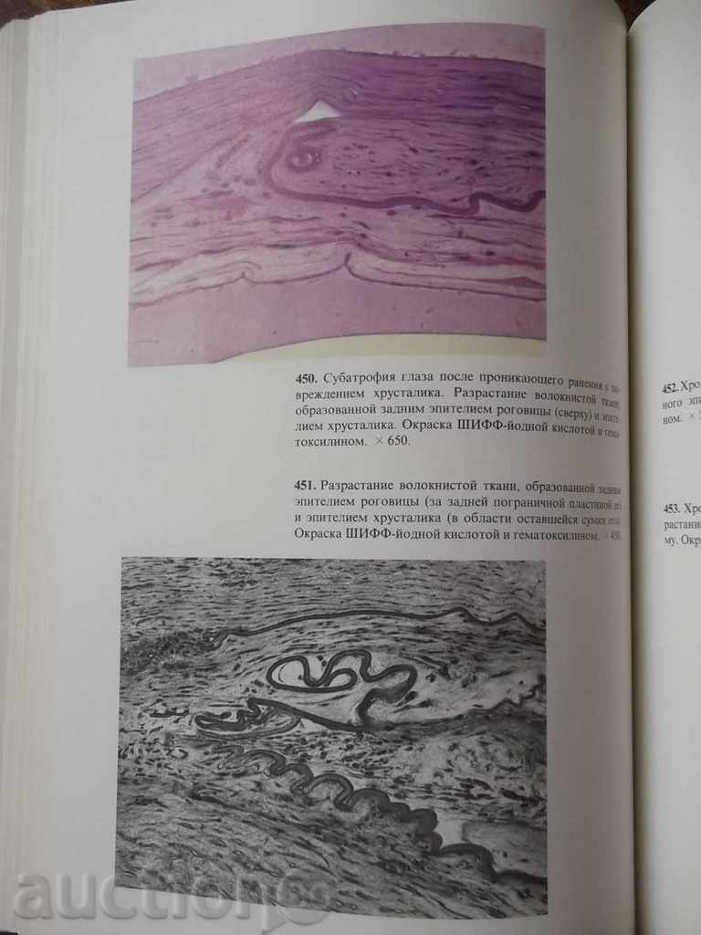 Delivery of Atlas of Ophthalmology (in Russian) 1980