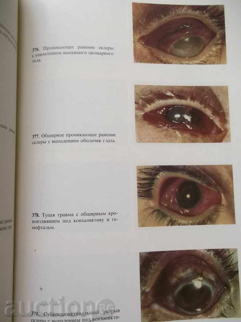 Atlas of Ophthalmology (in Russian) 1980 - 6