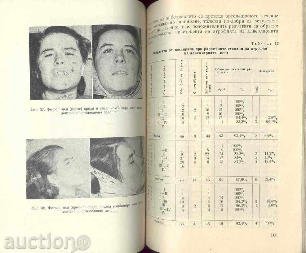 Orthopedic therapy of amphodontosis by immobilized with price 8.00 BGN | € 4.09